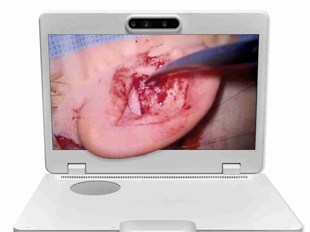 达擎之＂Heads-up 3D显微手术显示系统＂，，整合4K裸眼3D显示及眼球追踪系统，，，具备快速追踪人眼移动位置功能，，，减轻医师长时间维持固定姿势的负担，，，，让医师能有更宽广清晰的3D立体视野及更舒适的姿势来执行手术。。。。